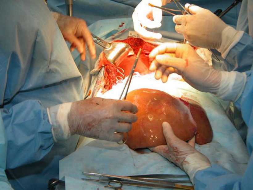 Cuerpo académico UAT trabaja en proyecto de trasplante de órganos